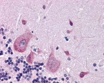 IHC testing of FFPE human cerebellum tissue with DPP10 antibody at 3.75ug/ml. Required HIER: steamed antigen retrieval with pH6 citrate buffer; AP-staining.
