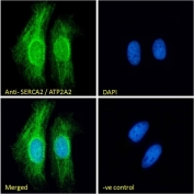 IF/ICC staining of fixed and permeabilized human HeLa cells with SERCA2 antibody (green) at 10ug/ml and DAPI nuclear stain (blue).