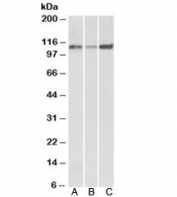 Western blot testing of human [A], mouse [B] and rat [C] heart lysates with SERCA2 antibody at 0.1ug/ml. Predicted molecular weight: ~110kDa.