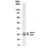 Western blot testing of human spleen lysate with Caveolin 1 antibody at 0.01ug/ml. Alpha and beta CAV1 differ by 30 amino acids at the N-terminus.