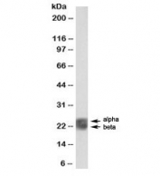 Western blot testing of human spleen lysate with biotinylated Caveolin 1 antibody at 1ug/ml. Alpha and beta CAV1 differ by 30 amino acids at the N-terminus.