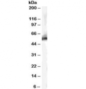Western blot testing of human liver lysate with MDM2 antibody at 0.3ug/ml. Predicted molecular weight: ~55 kDa but can be observed at up to ~90 kDa.