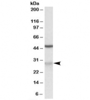 Western blot testing of Jurkat lysate with MOB2 antibody at 0.02ug/ml. The expected ~30kDa band and the additional ~48kDa band are both blocked by the immunizing peptide.