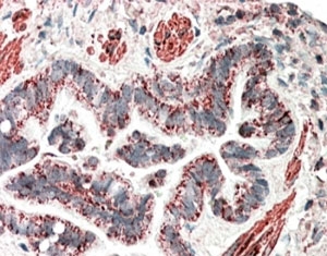 IHC staining of FFPE human lung with MOB2 antibody at 5ug/ml. HIER: steamed with pH6 citrate buffer, AP-staining.~