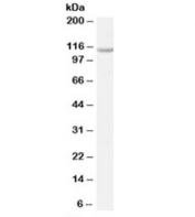 Western blot testing of K562 cell lysate with VDP p115 antibody at 0.3ug/ml. Predicted molecular weight: ~108kDa but routinely observed at 108~115kDa.