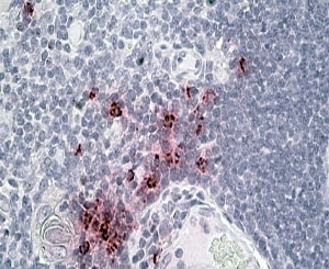 IHC staining of FFPE human thymus with Defensin 1/3 antibody at 4ug/ml. HIER: steamed with pH6 citrate buffer, AP-staining.~