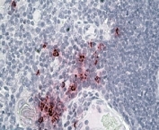 IHC staining of FFPE human thymus with Defensin 1/3 antibody at 4ug/ml. HIER: steamed with pH6 citrate buffer, AP-staining.