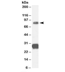 Western blot testing of human cerebellum lysate with FOXP2 antibody at 0.3ug/ml. Predicted molecular weight: 80~83 kDa. Both bands block with immunizing peptide.~