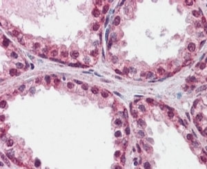 IHC staining of FFPE human prostate with FOXP2 antibody at 2.5ug/ml. HIE