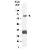 Western blot testing of human cerebellum lysate with FOXP2 antibody at 0.3ug/ml. Predicted molecular weight: 80~83 kDa. Both bands block with immunizing peptide.