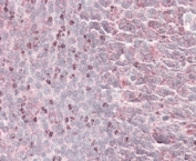 IHC staining of FFPE human tonsil with SEPT6 antibody at 4ug/ml. HIER: steamed with pH6 citrate buffer, AP-staining. The dividing cells outside the germinal center are specifically stained.