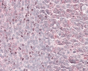 IHC staining of FFPE human tonsil with SEPT6 antibody at 4ug/ml. HIER: steamed with pH6 citrate buffer, AP-staining. The di