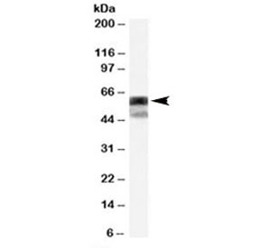 Western blot testing of HEK293 cell lysate with P4HA1 antibody at 0.2ug/ml. The expected ~60kDa and additional ~48kDa band are both blocked by the immunizing peptide.