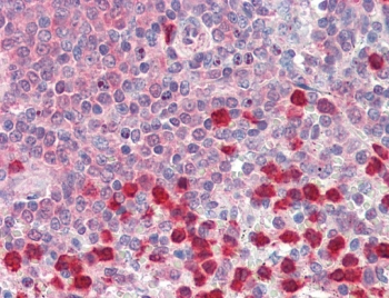 IHC testing of FFPE human spleen tissue with P4HA1 antibody at 5ug/ml. Required HIER: steamed antigen retrieval with pH6 citrate buffer; AP-staining.