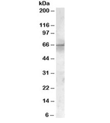 Western blot testing of rat heart lysate with PDK1 antibody at 1ug/ml. Predicted/observed molecular weight ~49/64kDa.