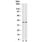 Western blot testing of fetal mouse brain (A) and adult rat brain (B) lysates with ARPC1A antibody at 0.1ug/ml. Predicted molecular weight: ~42/39 kDa (isoform 1/2).