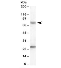 Western blot testing of human liver lysate with LGP2 antibody at 0.3ug/ml. Predicted molecular weight: 77kDa. Both observed bands are blocked by addition of the immunizing peptide.