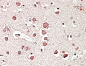 IHC staining of FFPE human cerebral cortex with Neurobeachin antibody at 5ug/ml. HIER: steamed with pH6 citrate buffer, AP-staining.