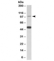 Western blot testing of human cerebellum lysate with PTCHD1 antibody at 0.5ug/ml. The expected ~100kDa band and the additional ~50kDa band are both blocked by the immunizing peptide.