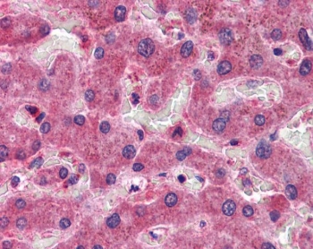 IHC testing of FFPE human liver tissue with CREB3L1 antibody at 3.75ug/ml. Required HIER: steamed antigen retrieval with pH6 citrate buffer; AP-staining.