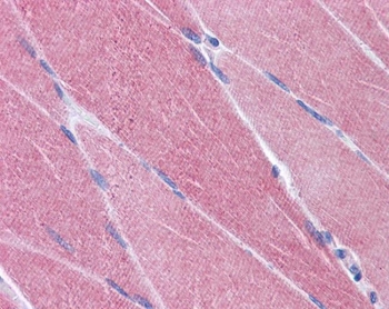 IHC testing of FFPE human skeletal muscle tissue with CREB3L1 antibody at 3.75ug/ml. Required HIER: steamed antigen retrieval with pH6 citrate buffer; AP-staining.