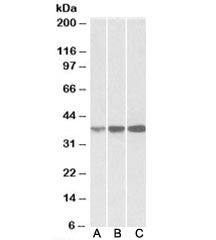 Western blot of human (A), mouse (B) and rat (C) spleen lysates with IDH3A antibody at 0.1ug/ml. Predicted molecular weight: ~39kDa.