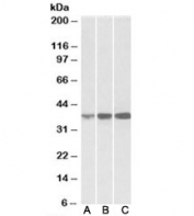 Western blot of human (A), mouse (B) and rat (C) spleen lysates with IDH3A antibody at 0.1ug/ml. Predicted molecular weight: ~39kDa.