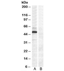 Western blot testing of COS7 cell lysate transfected with full length human DCDC2 [A] and untransfected control COS7 cells [B] with DCDC2 antibody at 0.2ug/ml. Predicted molecular weight: ~53/26kDa (isoforms 1/2).~