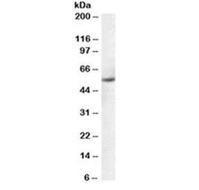 Western blot testing of human ovay lysate with PTBP1 antibody at 0.1ug/ml. Predicted molecular weight ~57kDa.