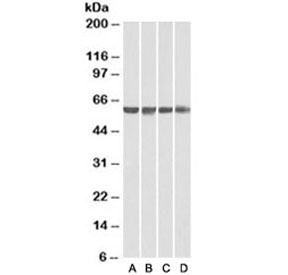 Western blot of human A) HeLa, B) HepG2, C) Jurkat and D) HEK293 nuclear lysates with PTBP1 antibody at 0.01ug/ml. Predicted molecular weight ~57 kDa.
