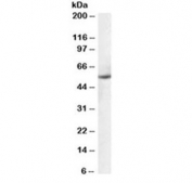 Western blot testing of human ovay lysate with PTBP1 antibody at 0.1ug/ml. Predicted molecular weight ~57 kDa.