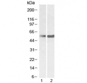 Western blot testing of 1) mouse ovary and 2) rat ovary lysate with PTBP1 antibody at 0.3ug/ml. Predicted molecular weight ~57 kDa.