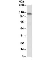 Western blot testing of human skeletal muscle lysate with PGC1A antibody at 0.1ug/ml. Predicted molecular weight ~91kDa.