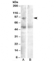 Western blot testing of human ovay lysate with SULF2 antibody at 0.3ug/ml with [B] and without [A] blocking/immunizing peptide. Predicted molecular weight: ~98kDa.