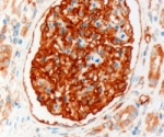 IHC staining of FFPE human kidney with NHERF2 antibody at 3ug/ml. HIER: microwaved with pH9 Tris/EDTA buffer, HRP-staining.