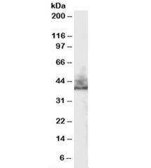 Western blot testing of human kidney lysate with NHERF2 antibody at 0.3ug/ml. Predicted molecular weight: ~37kDa.~