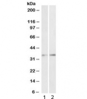 Western blot testing of 1) human skin and 2) pig lung lysate with CEBPB antibody at 1ug/ml. Predicted molecular weight: 36-41 kDa.