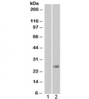 Western blot of HEK293 lysate overexpressing SAR1B probed with SAR1B antibody (mock transfection in lane 1). Predicted molecular weight: ~22kDa.