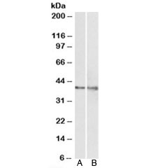 Western blot of rat (A) and pig (B) heart lysate with IDH3G antibody at 1ug/ml. Predicted molecular weight: ~41kDa.