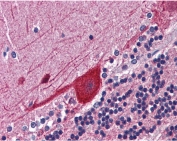 IHC testing of FFPE human cerebellum tissue with FKBP52 antibody at 3.75ug/ml. Required HIER: steamed antigen retrieval with pH6 citrate buffer; AP-staining.