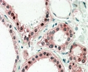 IHC staining of FFPE human thyroid gland with UXT antibody at 5ug/ml. HIER: steamed with pH6 citrate buffer, AP-staining. Cytoplasmic staining with minor nuclear staining is seen.