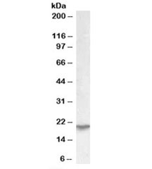 Western blot testing of human kidney lysate with UXT antibody at 0.03ug/ml. Predicted molecular weight: ~20kDa.~