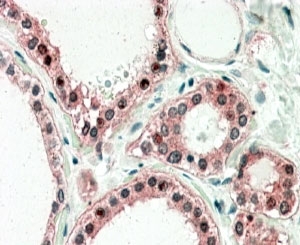 IHC staining of FFPE human thyroid gland with UXT antibody at 5ug/ml. HIER: steamed with pH6 citrate buffer, AP-staining.