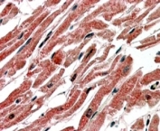 IHC testing of FFPE human heart with CPT1B antibody at 4ug/ml. HIER: steamed with pH6 citrate buffer, AP-staining.
