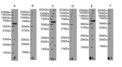 Western blot testing of A) human Daudi cell lysate without immunizing peptide, B) human Daudi cell lysate with immunizing peptide, C) human U937 cell lysate without immunizing peptide, D) human U937 cell lysate with immunizing peptide, E) human HEK293 cell lysate (nuclear fraction) without immunizing peptide, F) human HEK293 cell lysate (nuclear fraction) with immunizing peptide, with NEIL1 antibody.