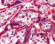 IHC testing of FFPE human placenta with NEIL1 antibody at 5ug/ml. HIER: steamed with pH6 citrate buffer, AP-staining.