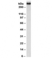Western blot testing of human uterus lysate with Filamin A antibody at 0.1ug/ml. Predicted molecular weight ~281kDa.