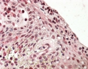 IHC staining of FFPE human tonsil with PRDM1 antibody at 4ug/ml. HIER: steamed with pH6 citrate buffer, AP-staining.
