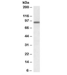 Western blot testing of A431 lysate with PRDM1 antibody at 0.3ug/ml. Predicted molecular weight: ~92/77kDa (isoforms 1/2).~