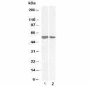 Western blot testing of 1) human epithelial colorectal adenocarcinoma cell lysate and 2) human HeLa cell lysate with NOX1 antibody at 0.1ug/ml. Predicted molecular weight ~59 kDa.